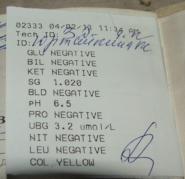 My urine analysis leads to femixal